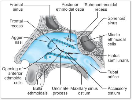 Sinus anatomy diagram showing the drainage pathways of the paranasal sinuses